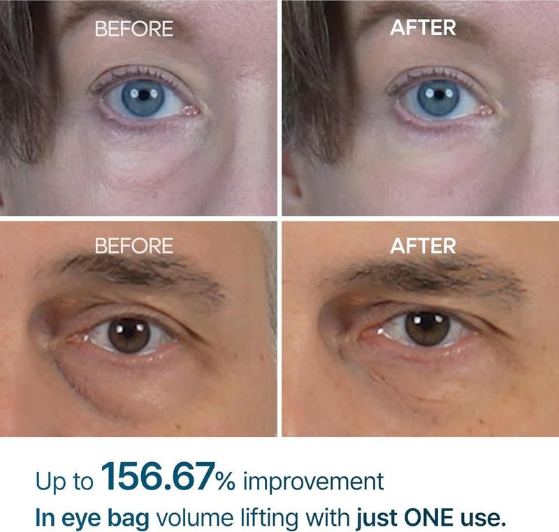 Dr Melaxin Eyephalt Eyecream