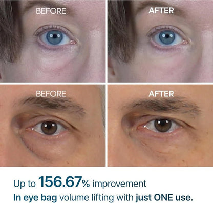 Dr Melaxin Eyephalt Eyecream